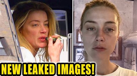 amber heard bruises are fake